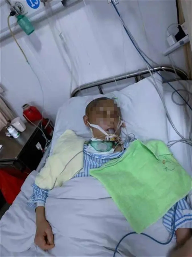 丧心病狂！男子家暴妻子，致其头骨开裂昏迷63天(图1)