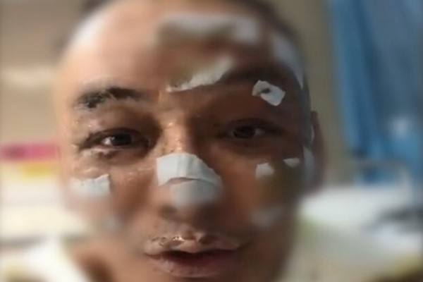 歌手徐真真全身二级深度烧伤，因点燃香薰蜡烛引发火灾(图1)