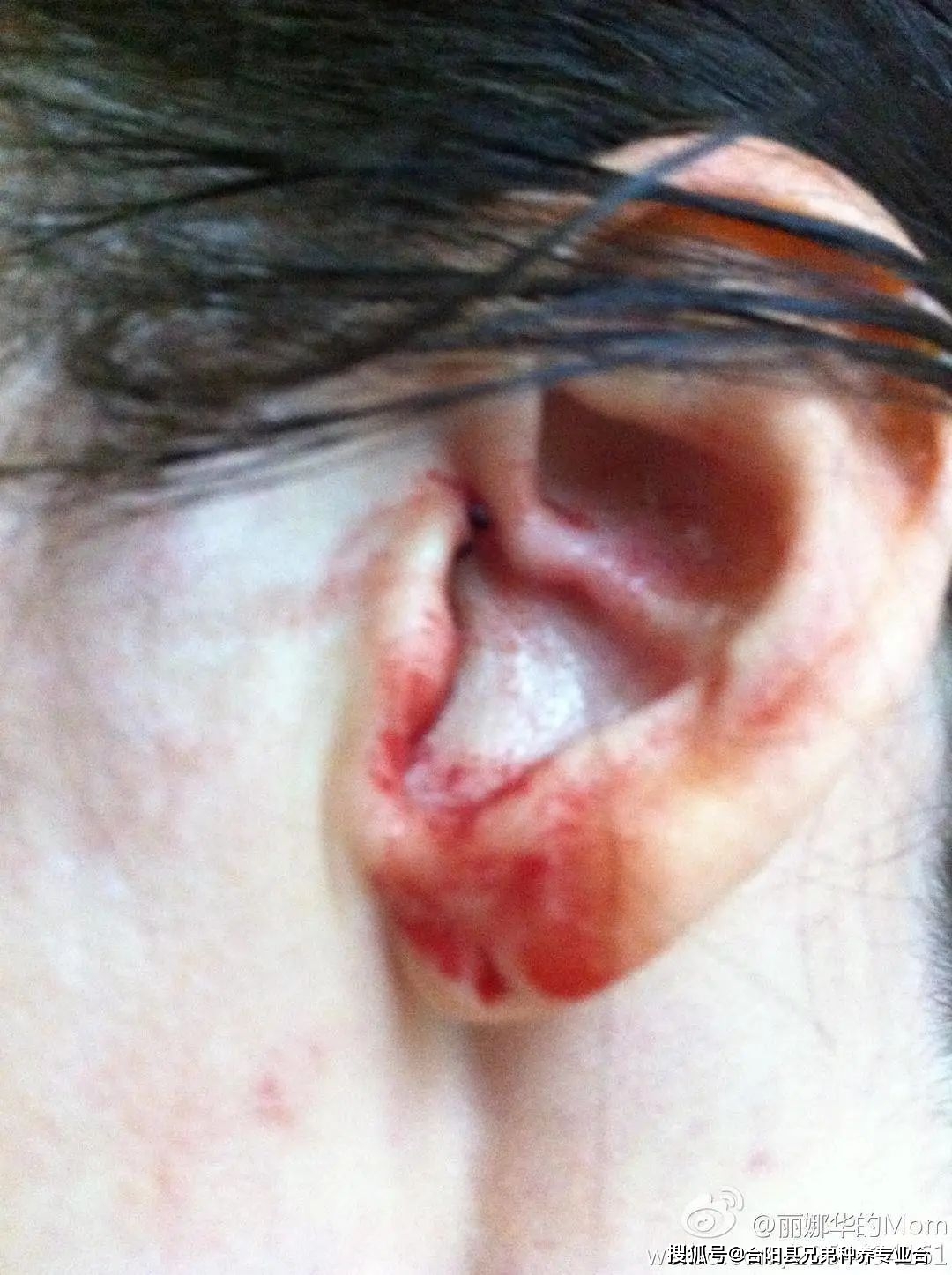 李阳家暴门后首发声:将起诉前妻(图3)